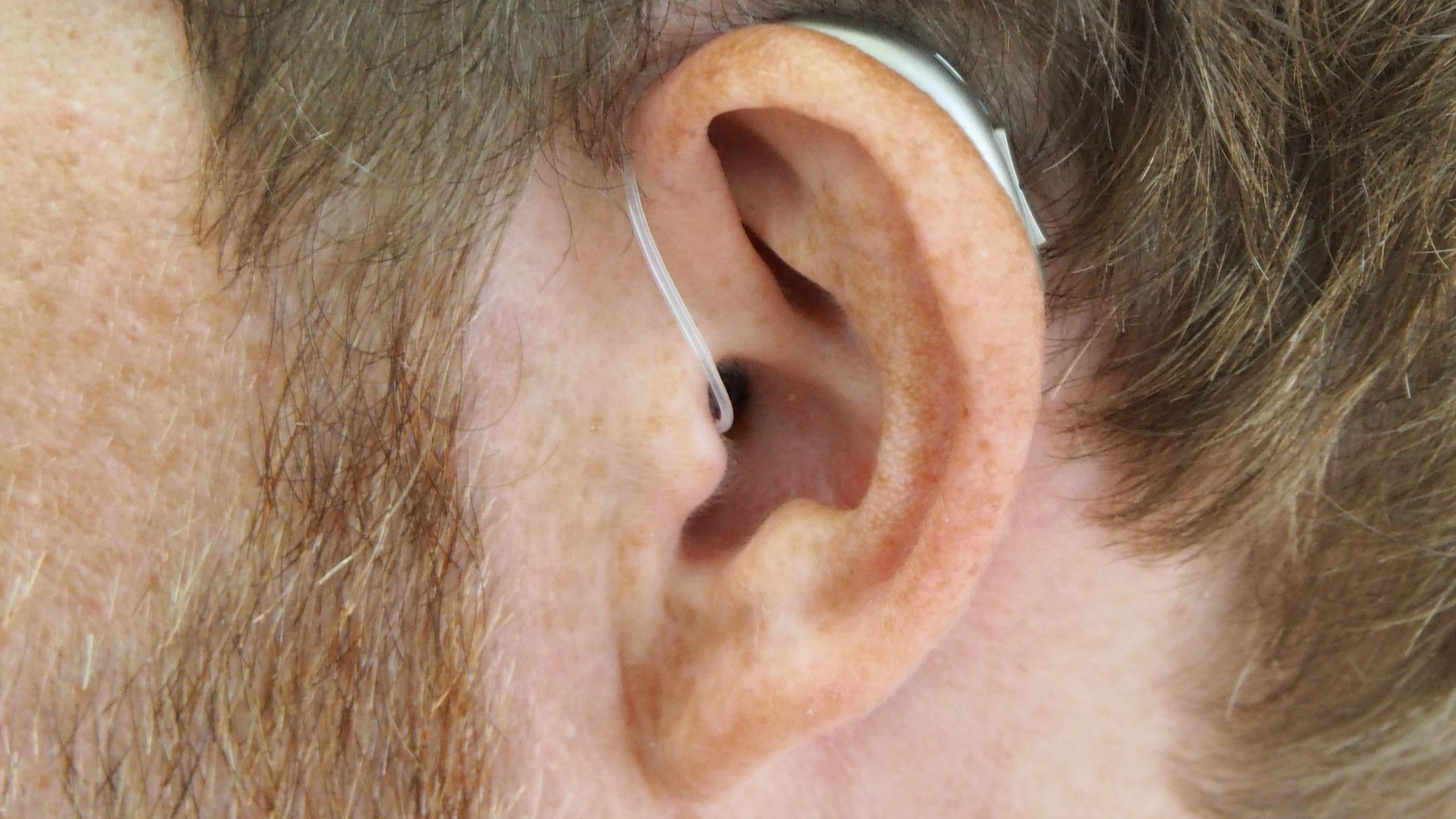 Ear with hearing aid